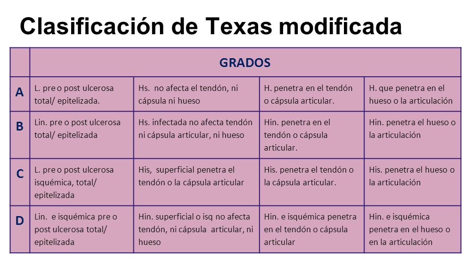 Poker Reglas: TDA